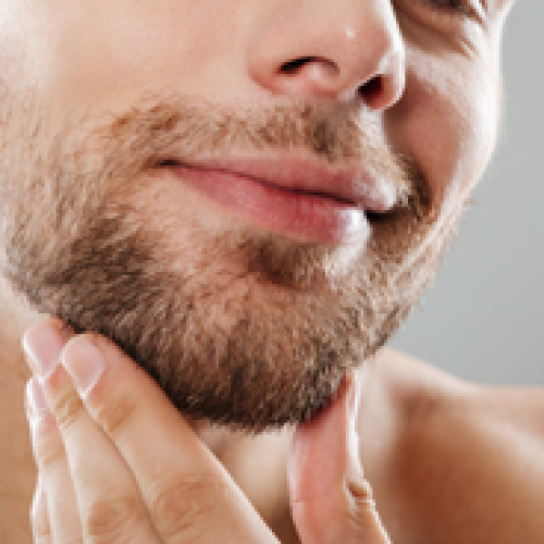 Beard Transplant