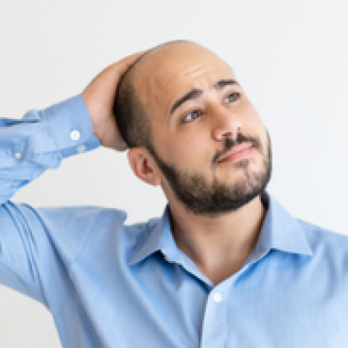 How Lifestyle Choices Affect Hair Loss and Hair Growth